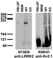 Immunoblot versus rat brain low-speed pellet (LSP), mouse brain membranes (MBM) and wild-type (WT) and LRRK2 KO mouse samples probed with N138/6 (left) and K89/41 (right) TC supe. Mouse brain samples provided by Xiaojie Li, Ted Dawson and Valina Dawson (Johns Hopkins University).