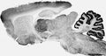 Adult rat brain immunohistochemistry.