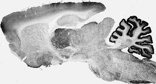 Adult rat brain immunohistochemistry.
