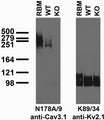 Immunoblot of crude brain membranes from adult rat (RBM) and Cav3.1 wild-type (WT) and knockout (KO) mice and probed with N178A/9 (left) and K89/34 (right). Mouse brains courtesy of Stefan Dubel and Jean-Philippe Pin, CNRS.