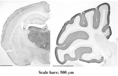 Mouse brain staining, thalamus and cortex (left) and molecular layer of cerebellum (right). Images courtesy of Laxmi Parajuli and Ryuichi Shigemoto, NIPS.