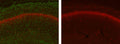 Adult WT (left) and KO (right) mouse hippocampus immunofluorescence with N206A/8 (green) and KC rabbit anti- Kv2.1 (red). Brain samples courtesy of Albee Messing, University of Wisconsin at Madison.