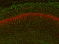 Adult WT and KO mouse hippocampus immunofluorescence with N206A/8 (green) and KC rabbit anti- Kv2.1 (red). Brain samples courtesy of Albee Messing, University of Wisconsin at Madison.