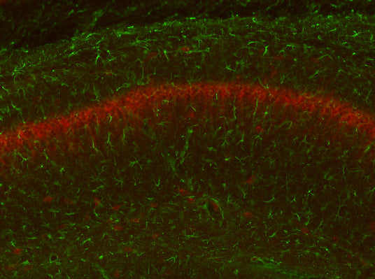 Adult WT and KO mouse hippocampus immunofluorescence with N206A/8 (green) and KC rabbit anti- Kv2.1 (red). Brain samples courtesy of Albee Messing, University of Wisconsin at Madison.