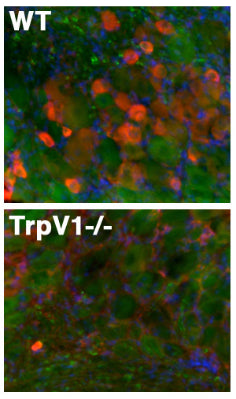 Immunofluorescence staining of adult dorsal root ganglion sections from TrpV1 WT and -/- mice with N221/17 TC supe (red), Kv1.2 rabbit polyclonal (green) and Hoechst nuclear stain (blue). Images courtesy of Matthew Rasband (Baylor College of Medicine).
