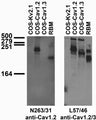Tissue and transfected cell immunoblot: extracts of rat brain membrane (RBM) and COS cells transiently transfected with untagged Cav1.2, Cav1.3 or Kv2.1 plasmids and probed with N263/31 (left) and L57/46 (right) TC supe.