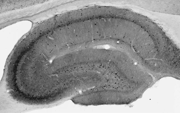 Adult rat hippocampus immunohistochemistry.