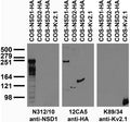 Transfected cell immunoblot: extracts of COS cells transiently transfected with HA-tagged NSD1, NSD2, NSD3 or untagged Kv2.1 plasmids and probed with N312/10 (left), 12CA5 (middle) and K89/34 (right).