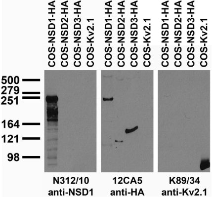 Transfected cell immunoblot: extracts of COS cells transiently transfected with HA-tagged NSD1, NSD2, NSD3 or untagged Kv2.1 plasmids and probed with N312/10 (left), 12CA5 (middle) and K89/34 (right).