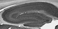 Adult rat hippocampus immunohistochemstry.