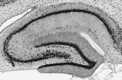 Adult rat hippocampus immunohistochemistry (with antigen retrieval via sodium citrate pretreatment).