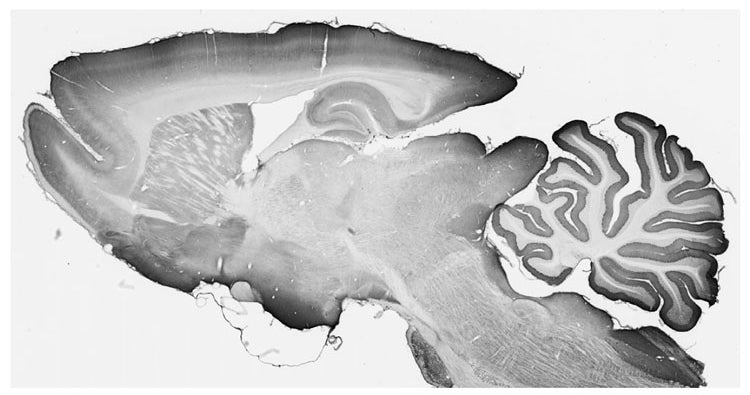 Adult rat brain immunohistochemistry