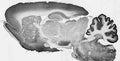 Adult rat brain immunohistochemistry.