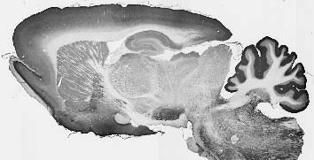 Adult rat brain immunohistochemistry.