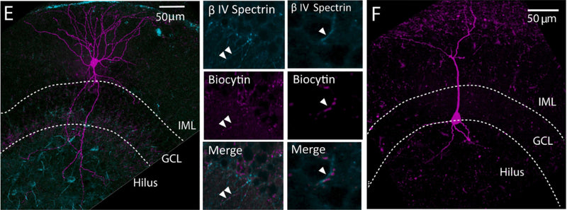 Confocal image stacks of representative Axo-axonic cells (AAC) (E) and Basket Cells (F). Center images illustrate two examples of axons from the cell in E showing close apposition for βIV-spectrin (cat. 75-376, 1:500) labeling for axon initial segments (top), biocytin (middle) and merged (bottom). Arrowheads indicate regions of close apposition between βIV-spectrin labeling on axon initial segment of Granule Cell (GC) and biocytin filled axonal cartridge of AAC. CC-BY-4.0. PMID:37898313