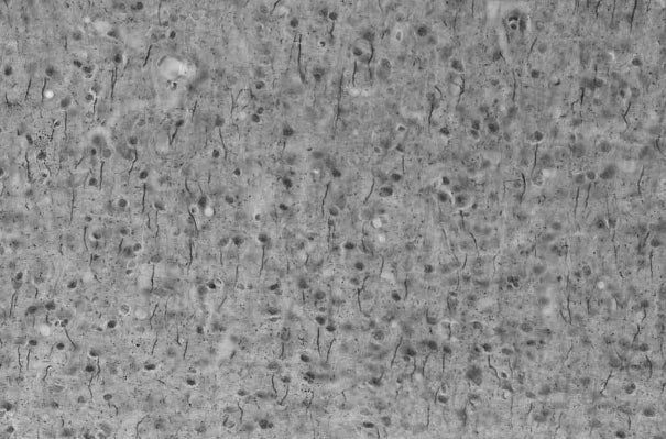 Adult rat cerebral cortex immunohistochemistry.