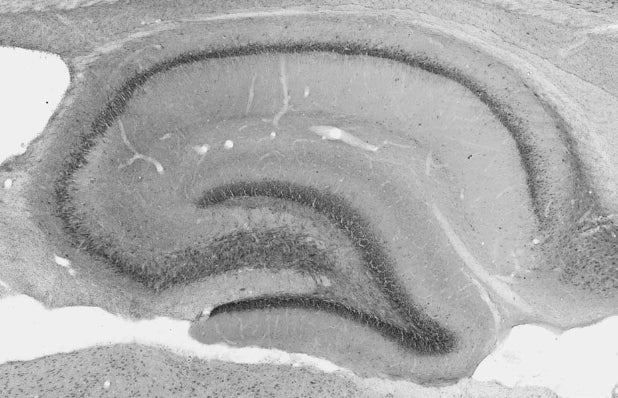 Hippocampus immunohistochemistry with antigen retrieval via pepsin pretreatment showing axon initial segment and nodal staining.