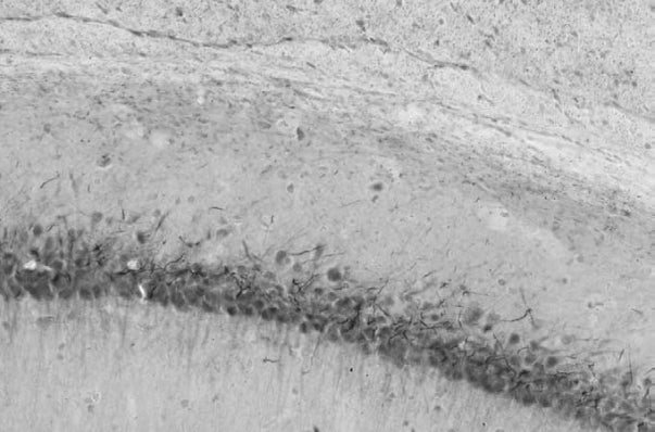 Higher magnification of corpus callosum and CA1.