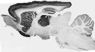 Adult rat brain immunohistochemistry.