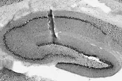 Hippocampus Immunohistochemistry from adult rats treated with kainic acid.
