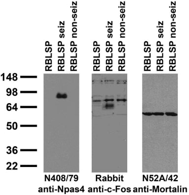 Immunoblot against crude brain low-speed pellets from untreated adult rats (RBLSP), adult rats treated with kainic acid to induce seizures (RBLSP seiz) and adult rats treated with saline (RBLSP non-seiz) probed with N408/79 (left) and N52A/42 (right) TC supe and with Rabbit anti-c-Fos (middle).