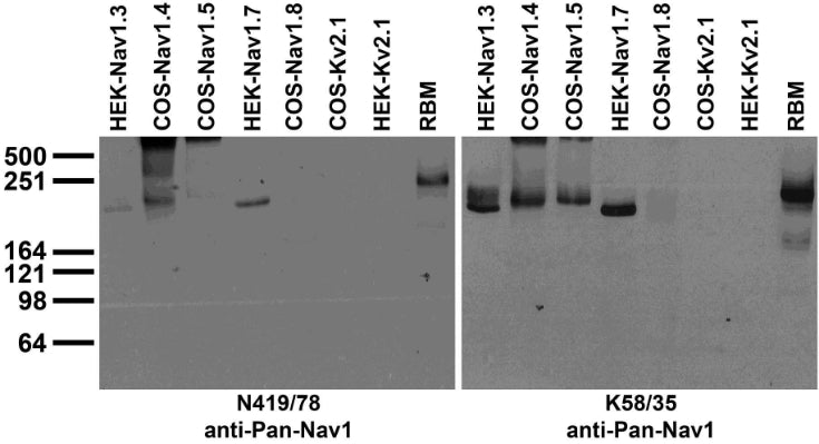 Immunoblot against fractions of adult rat brain membranes (RBM) and extracts of COS or HEK cells transiently or stably expressing different untagged Nav1.X or Kv2.1 plasmid probed with N419/40 (left) or K58/35 (right) TC supe.