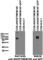 Immunoblot against extracts of COS cells transiently transfected with untagged ANO5/TMEM16E, GFP- tagged ANO6/TMEM16F or untagged Kv2.1 plasmid probed with N421A/85 (left) or N86/38 (right) TC supe.
