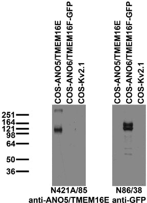 Immunoblot against extracts of COS cells transiently transfected with untagged ANO5/TMEM16E, GFP- tagged ANO6/TMEM16F or untagged Kv2.1 plasmid probed with N421A/85 (left) or N86/38 (right) TC supe.