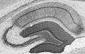 Adult rat hippocampus immunohistochemistry.
