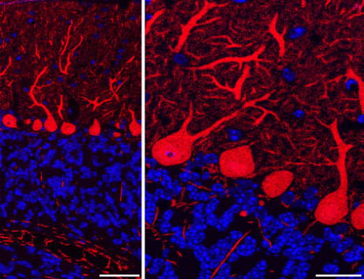 Array tomography immunofluorescence of Lowicryl-embedded sections from adult mouse cerebellum with L109/57 (red) and DAPI (blue). Left panel is a single 70 nm section imaged with a 20X objective, with a scale bar of 50 µm. Right panel is a MAX projection of 10 serial 70 nm sections imaged with a 63X objective, with a scale bar of 20 µm. Images courtesy of Kristina Micheva (Stanford).