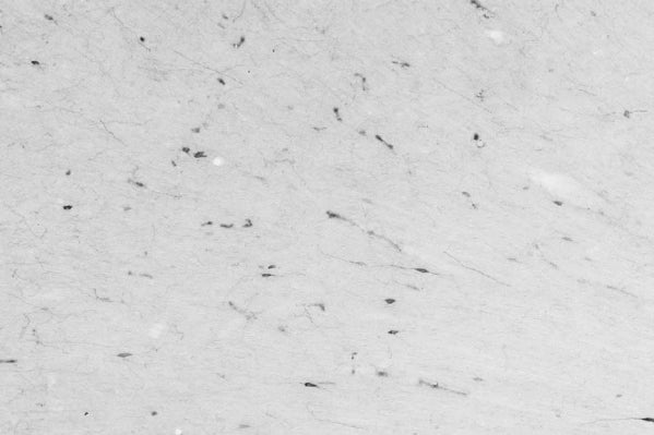 Adult rat cortex immunohistochemistry.