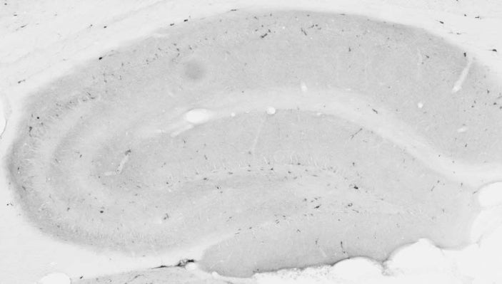 Adult rat hippocampus immunohistochemistry.