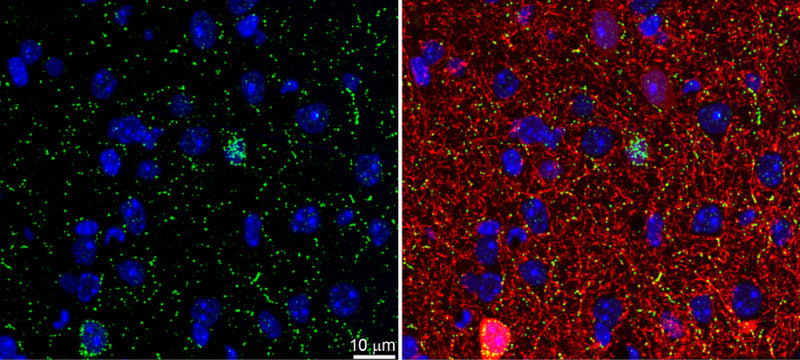 Array tomography immunofluorescence of Lowicryl-embedded sections from adult mouse cortex layer 2/3 with L115/13 (green), GABA (red) and DAPI (blue). Volume reconstruction of 35 serial 70 nm sections show two NPY-positive neurons with varying levels of GABA reactivity, as well as some NPY-reactive axonal varicosities. Images courtesy of Kristina Micheva (Stanford).