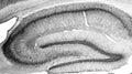 Adult rat hippocampus immunohistochemistry.