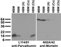Immunoblot against crude membranes from whole mouse (MBM) or rat (RBM) brain and from human hippocampus [HBM(H)], cerebral cortex [HBM(Cx)] or cerebellum [HBM(Cb)] probed with L114/81 (left) or N52A/42 (right) TC supe.