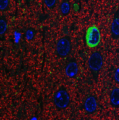 Array tomography immunofluorescence volume reconstruction of 9 serial LRWhite-embedded 70 nm sections from adult mouse cortex layer 6 with L121/25 (green), rabbit Synapsin (Cell Signaling