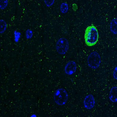 Array tomography immunofluorescence volume reconstruction of 9 serial LRWhite-embedded 70 nm sections from adult mouse cortex layer 6 with L121/25 (green), DAPI (blue). Image courtesy of Kristina Micheva (Stanford).