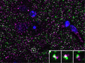 Array tomography immunofluorescence of an LRWhite-embedded 70 nm section from adult mouse cortex with L124/59 (magenta), rabbit mAb PSD-95 (Cell Signaling 3450, green) and Hoechst nuclear stain (blue). The insert shows three consecutive sections through the synapse that is marked with a white box.