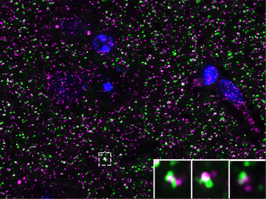 Array tomography immunofluorescence of an LRWhite-embedded 70 nm section from adult mouse cortex with L124/59 (magenta), rabbit mAb PSD-95 (Cell Signaling