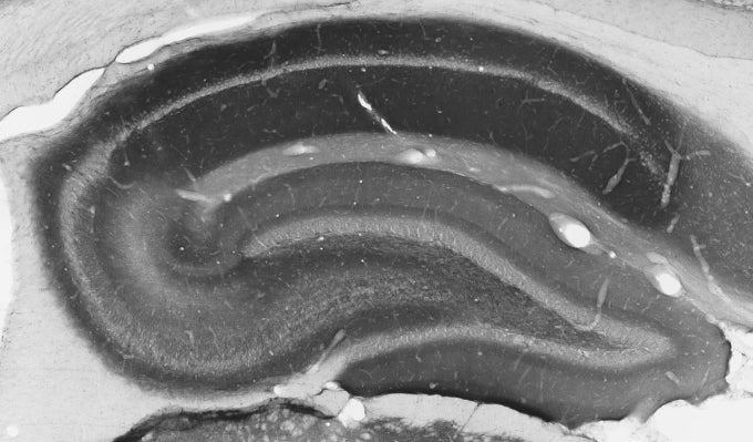 Adult rat hippocampus immunohistochemistry.