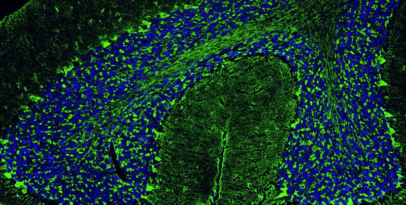 Immunohistochemistry for detection of PSD-95 in adult rat cerebellum using Anti-PSD-95 Recombinant Chimeric Guinea Pig Monoclonal antibody [K28/43] (Cat No. 74-028). Tissue was fixed with 4% paraformaldehyde and paraffin embedded. Heat induced antigen retrieval was performed using citrate buffer (Cat No. AR-6544) and then blocked with Immuno Protein Blocking Solution with Goat Serum (Cat No. AR-6591). The anti-PSD-95 antibody (Cat No. 74-028) was incubated with the sample at a dilution of 1:250 at 4C overnight. After washing with PBST, the sections were stained using goat anti-guinea pig 488 secondary antibody (green). DAPI nuclear stain (blue) shows cell nuclei. Anti-PSD-95 specifically stains the excitatory synapses in the granular layer of the cerebellum.​ 