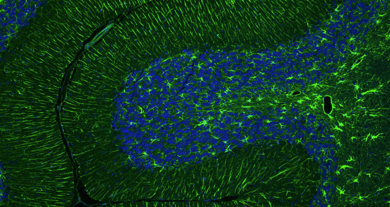Immunohistochemistry for detection of GFAP in adult rat cerebellum using Anti-GFAP Recombinant Chimeric Guinea Pig Monoclonal antibody [N206A/8] (Cat No. 74-240). Tissue was fixed with 4% paraformaldehyde and paraffin embedded. Heat induced antigen retrieval was performed using citrate buffer (Cat No. AR-6544) and then blocked with Immuno Protein Blocking Solution with Goat Serum (Cat No. AR-6591). The anti-GFAP antibody (Cat No. 74-240) was incubated with the sample at a dilution of 1:250 at 4C overnight. After washing with PBST, the sections were stained using goat anti-guinea pig 488 secondary antibody (green). DAPI nuclear stain (blue) shows cell nuclei. Anti-GFAP specifically stains the astrocytes in the rat brain cerebellum.​ 