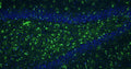 Immunohistochemistry for detection of GFAP in adult rat hippocampus using Anti-GFAP Recombinant Chimeric Guinea Pig Monoclonal antibody [N206A/8] (Cat No. 74-240). Tissue was fixed with 4% paraformaldehyde and paraffin embedded. Heat induced antigen retrieval was performed using citrate buffer (Cat No. AR-6544) and then blocked with Immuno Protein Blocking Solution with Goat Serum (Cat No. AR-6591). The anti-GFAP antibody (Cat No. 74-240) was incubated with the sample at a dilution of 1:250 at 4C overnight. After washing with PBST, the sections were stained using goat anti-guinea pig 488 secondary antibody (green). DAPI nuclear stain (blue) shows cell nuclei. Anti-GFAP specifically stains the astrocytes in the rat brain hippocampus.​ 