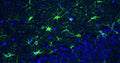 Immunohistochemistry for detection of GFAP in adult rat hippocampus using Anti-GFAP Recombinant Chimeric Guinea Pig Monoclonal antibody [N206A/8] (Cat No. 74-240). Tissue was fixed with 4% paraformaldehyde and paraffin embedded. Heat induced antigen retrieval was performed using citrate buffer (Cat No. AR-6544) and then blocked with Immuno Protein Blocking Solution with Goat Serum (Cat No. AR-6591). The anti-GFAP antibody (Cat No. 74-240) was incubated with the sample at a dilution of 1:250 at 4C overnight. After washing with PBST, the sections were stained using goat anti-guinea pig 488 secondary antibody (green). DAPI nuclear stain (blue) shows cell nuclei. Anti-GFAP specifically stains the astrocytes in the rat brain hippocampus.​ ​ 
