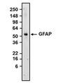 Western blot detection of GFAP using Anti-GFAP Recombinant Chimeric Guinea Pig Monoclonal antibody [N206A/8] (Cat No. 74-240). 10-20% Tris-Glycine Gel was loaded with rat brain membrane fraction. Proteins were transferred to PVDF membrane and blocked with 5% non-fat milk powder. Anti-GFAP antibody was incubated with sample at a concentration of 1 ug/ml and then detected via chemiluminescence (10 min) using a Goat Anti-Guinea Pig H+L, HRP conjugated secondary antibody. Anti-GFAP recognizes endogenous GFAP in the rat brain membrane fraction at the expected molecular weight of ~50 kDa. ​ 