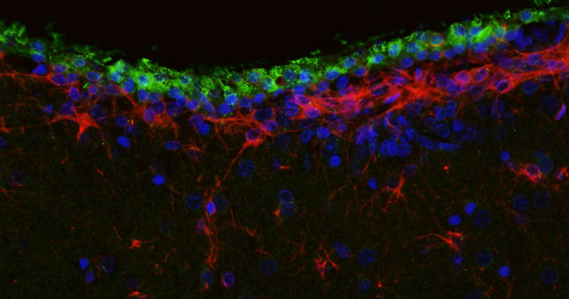 Immunohistochemistry for detection of Arl13b in adult rat brain lateral ventricle region using anti-Arl13b Recombinant Chimeric Guinea Pig Monoclonal antibody [N295B/66] (Cat No. 74-287) and co-stained with anti-GFAP Recombinant Chicken Monoclonal antibody [N206A/8] (Cat No. 78-240). Tissue was fixed with 4% paraformaldehyde and paraffin embedded. Heat induced antigen retrieval was performed using citrate buffer (Cat No. AR-6544) and then blocked with Immuno Protein Blocking Solution with Goat Serum (Cat. No AR-6591). The anti-Arl13b guinea pig antibody (Cat No. 74-240, 1:100) and anti-GFAP chicken antibody (Cat No. 78-240, 1:500) were incubated with the sample at 4C overnight. After washing with PBST, the sections were stained using goat anti-guinea pig 488 (green) and goat anti-chicken IgY CF594 (red) secondary antibodies. DAPI nuclear stain (blue) shows cell nuclei. Anti-Arl13b specifically stains the ciliated cells surrounding the lateral ventricle.​ 
