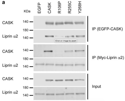 WB images for IP for analyzing binding affinity between CASK mutants and Liprin-α2. HEK293T cells were co-transfected with EGFP alone, EGFP fused WT or mutant CASK with R106P, E255C, or Y268H and Myc-tagged Liprin-α2 constructs. Cell lysates were immunoprecipitated with anti-GFP (IP EGFP-CASK) or anti-Myc antibody conjugated beads (IP Myc-Liprin). WB using anti-CASK (cat. 75-000, 1:2000) or anti-Myc antibodies for measurement of binding affinity. Image from publication CC-BY-4.0. PMID:37190086