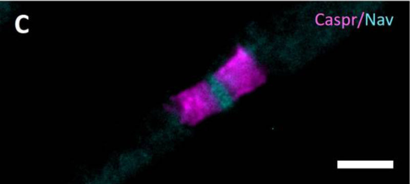 Immunofluorescence staining of the nodes of Ranvier analyzing hemiparanodal (Caspr1, cat. 75-001, 1:100; magenta) and nodal (pan-Nav, cyan) length. Image from publication CC-BY-4.0. PMID: 37388725