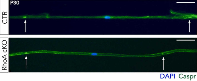 Immunofluorescence of teased fibers labeled for the paranodal protein CASPR (cat. 75-001, 1:500; green, arrows) and nuclei (in blue). Image from publication CC-BY-4.0. PMID:37315917