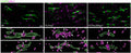 Representative immunofluorescence detection and IMARIS Z-stack surface rendering of CASPR (Cat. 75-001, 1:1000) and pMLC in the optic nerves of 12-month-old Wt, PLPmut, and PLPmut/Rag1−/− mice. pMLC is localized at normal appearing